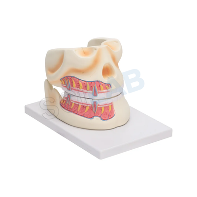 Human Upper & Lower Jaw